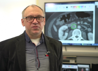 Druk 3D nadzieją onkologii. Polscy naukowcy wydrukowali trójwymiarowy model żyły zajętej nowotworem, co pozwoliło na skuteczną operację